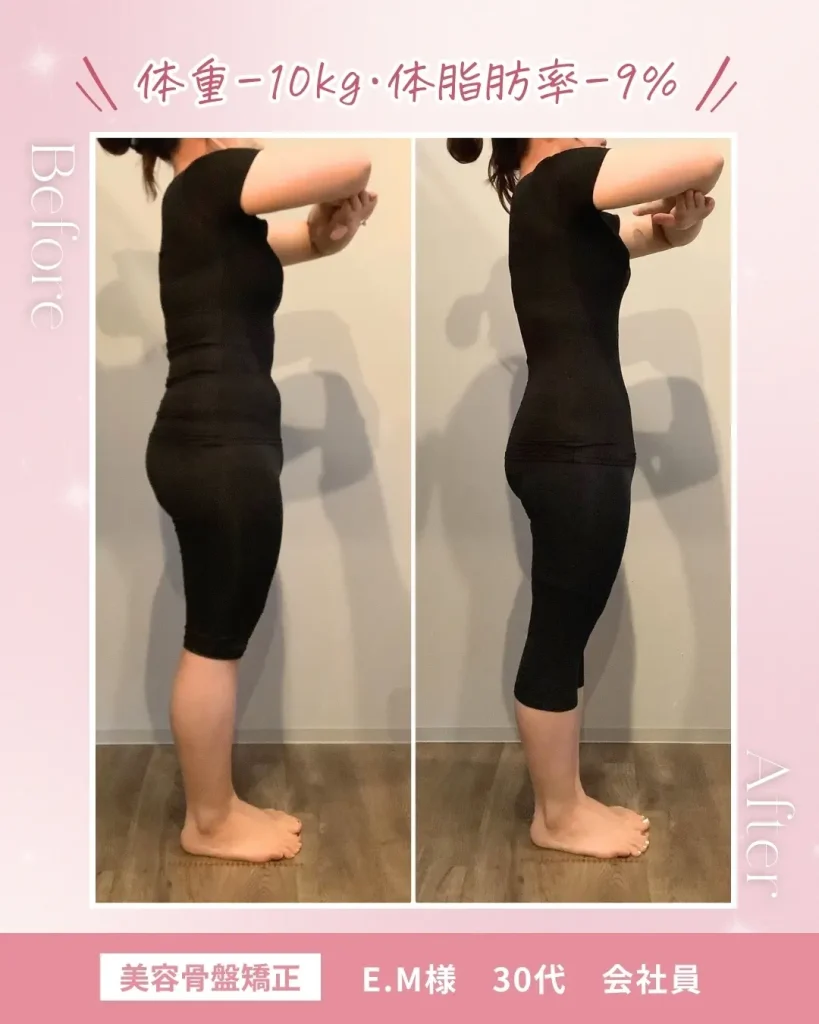 before/after